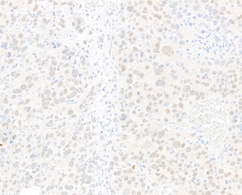 JDP2 Antibody