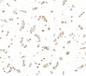 Rabbit anti-JDP2 Recombinant Monoclonal Antibody
