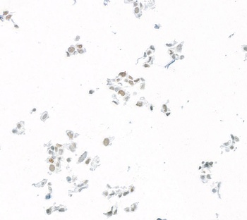 Rabbit anti-JDP2 Recombinant Monoclonal Antibody