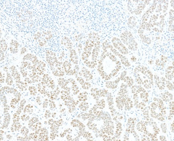 JDP2 Antibody