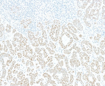 Rabbit anti-JDP2 Recombinant Monoclonal Antibody