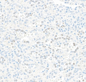 Rabbit anti-JDP2 Recombinant Monoclonal Antibody