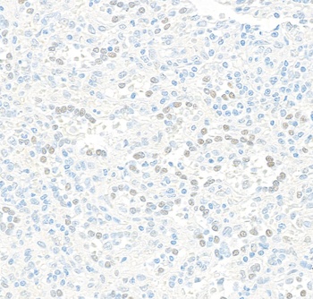 JDP2 Antibody