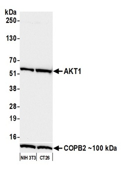 Rabbit anti-AKT1 Recombinant Monoclonal Antibody