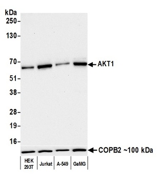 Rabbit anti-AKT1 Recombinant Monoclonal Antibody