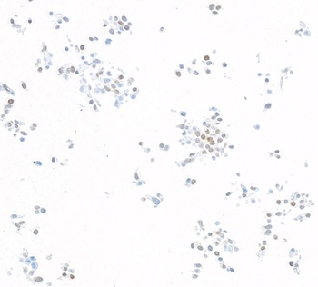 Rabbit anti-KLF5 Recombinant Monoclonal Antibody