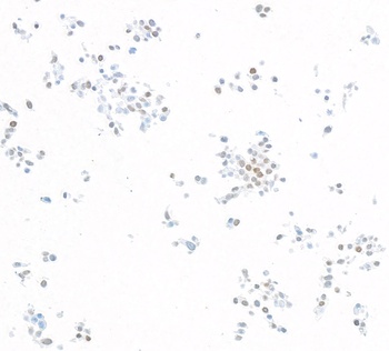 KLF5 Antibody