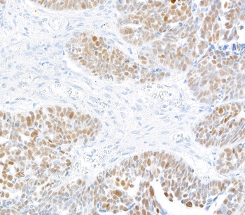 Rabbit anti-KLF5 Recombinant Monoclonal Antibody