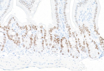 Rabbit anti-KLF5 Recombinant Monoclonal Antibody