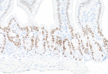 KLF5 Antibody