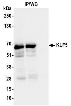 KLF5 Antibody