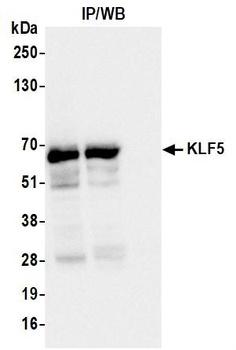 Rabbit anti-KLF5 Recombinant Monoclonal Antibody