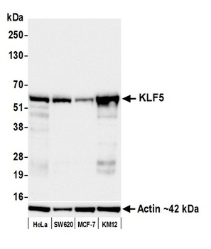 Rabbit anti-KLF5 Recombinant Monoclonal Antibody