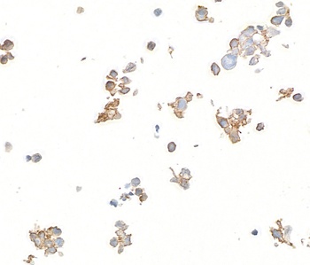Rabbit anti-B7-H6 Recombinant Monoclonal Antibody