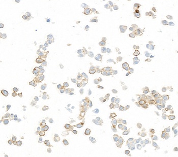 Rabbit anti-B7-H6 Recombinant Monoclonal Antibody