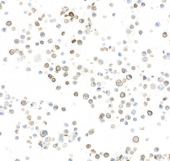 Rabbit anti-P-Selectin/CD62P Recombinant Monoclonal Antibody