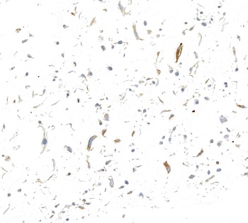 Rabbit anti-P-Selectin/CD62P Recombinant Monoclonal Antibody