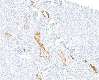 Rabbit anti-P-Selectin/CD62P Recombinant Monoclonal Antibody