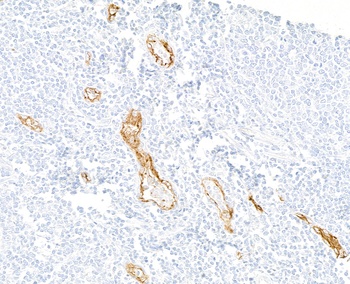 P-Selectin/CD62P Antibody