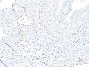 Rabbit anti-P-Selectin/CD62P Recombinant Monoclonal Antibody