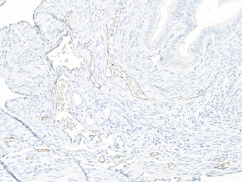 P-Selectin/CD62P Antibody