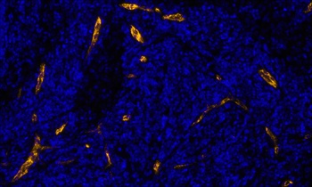 Rabbit anti-P-Selectin/CD62P Recombinant Monoclonal Antibody