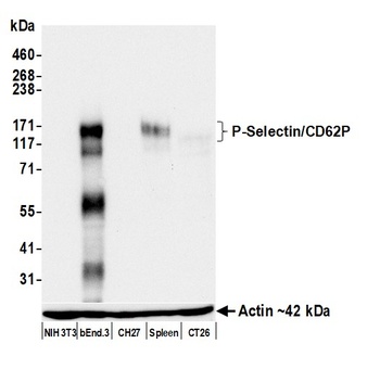 Rabbit anti-P-Selectin/CD62P Recombinant Monoclonal Antibody