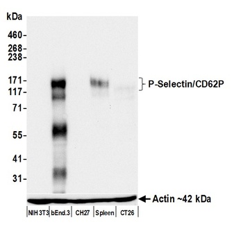 P-Selectin/CD62P Antibody