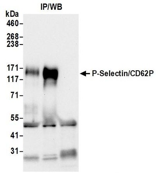 Rabbit anti-P-Selectin/CD62P Recombinant Monoclonal Antibody