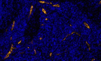 P-Selectin/CD62P Antibody