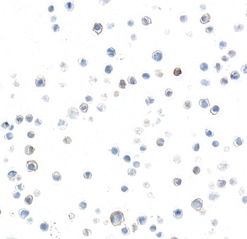 Rabbit anti-P-Selectin/CD62P Recombinant Monoclonal Antibody