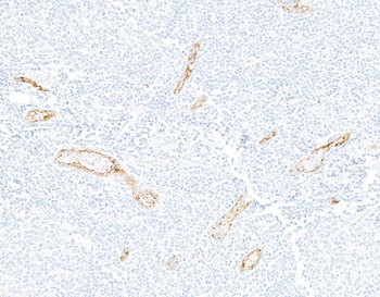 P-Selectin/CD62P Antibody