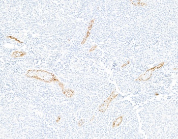 Rabbit anti-P-Selectin/CD62P Recombinant Monoclonal Antibody