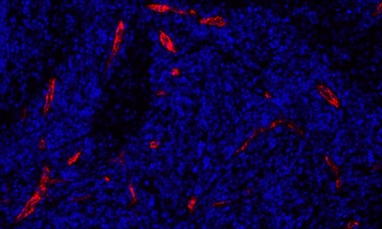 Rabbit anti-P-Selectin/CD62P Recombinant Monoclonal Antibody