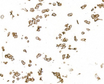 Rabbit anti-CD70 Recombinant Monoclonal Antibody