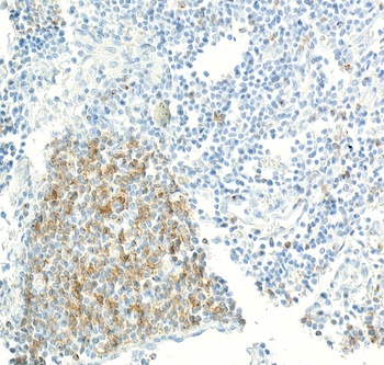 Rabbit anti-CD70 Recombinant Monoclonal Antibody