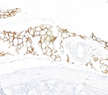 Rabbit anti-CD36 Recombinant Monoclonal Antibody