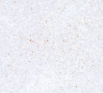 Rabbit anti-CTLA4 Recombinant Monoclonal Antibody