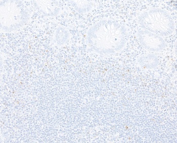 Rabbit anti-CTLA4 Recombinant Monoclonal Antibody