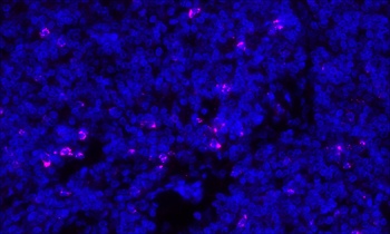 Rabbit anti-CTLA4 Recombinant Monoclonal Antibody