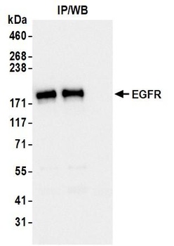 Rabbit anti-EGFR Recombinant Monoclonal Antibody