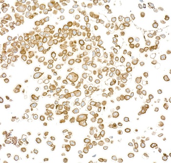 Rabbit anti-EGFR Recombinant Monoclonal Antibody
