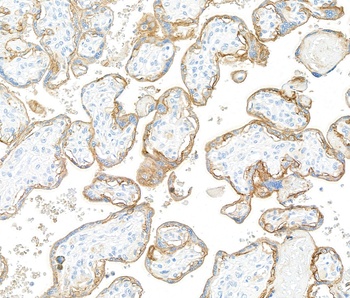 Rabbit anti-EGFR Recombinant Monoclonal Antibody
