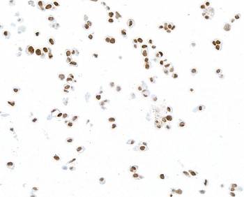 Mouse anti-PAX8 Monoclonal Antibody