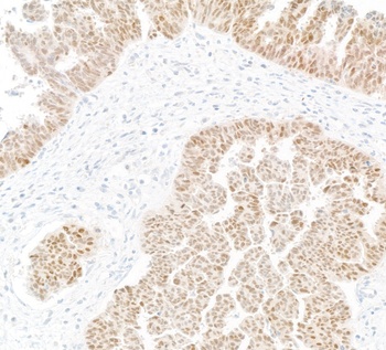 Mouse anti-PAX8 Monoclonal Antibody