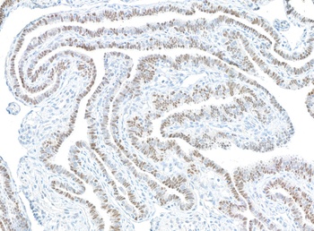 Mouse anti-PAX8 Monoclonal Antibody