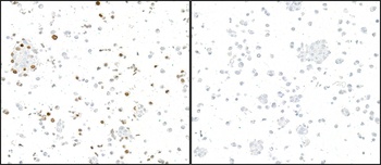 GFP Antibody