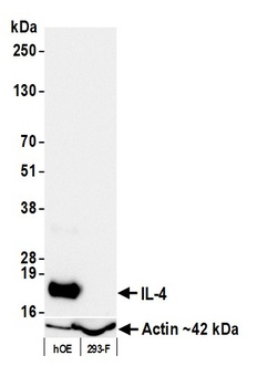 Rabbit anti-IL-4 Recombinant Monoclonal Antibody