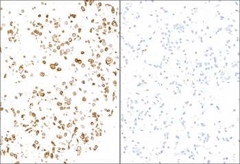 E-Selectin/CD62E Antibody