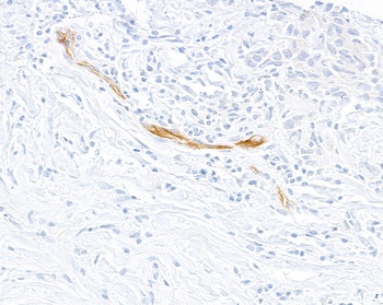 Rabbit anti-E-Selectin/CD62E Recombinant Monoclonal Antibody